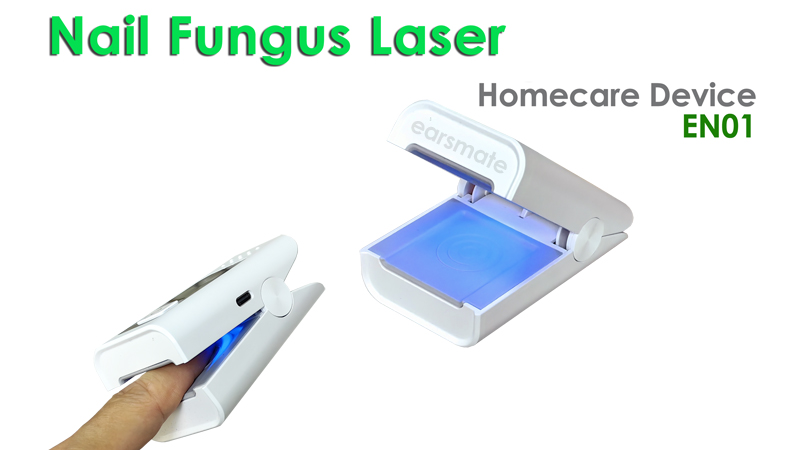 Toenail Fungus Laser Treatment at Home Earsmate EN01
