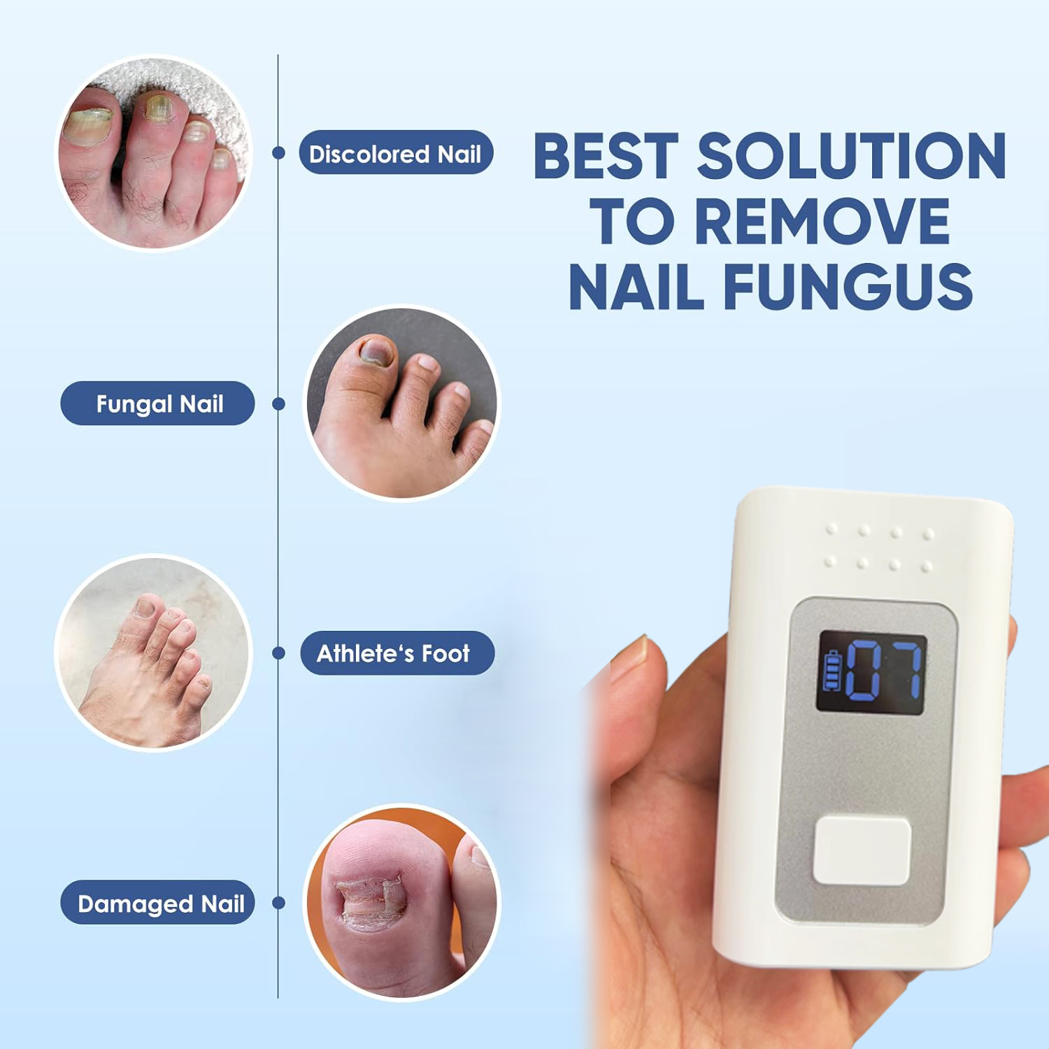 Cold laser nail fungus treatment
